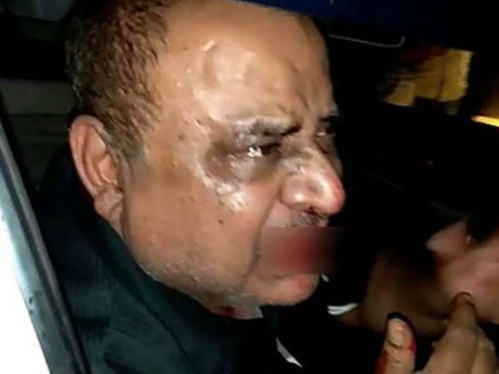 नशे में धुत DIG साहब को भीड़ ने इतना मारा कि खून से लाल हो गया मुंह, धरी रह गई वर्दी की धौंस