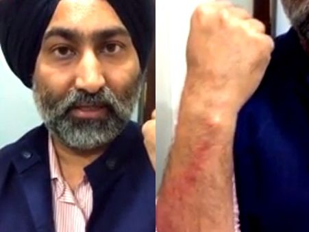 Fortis के फाउंडर मलविंदर सिंह ने छोटे भाई शिविंदर पर लगाया मारपीट का आरोप