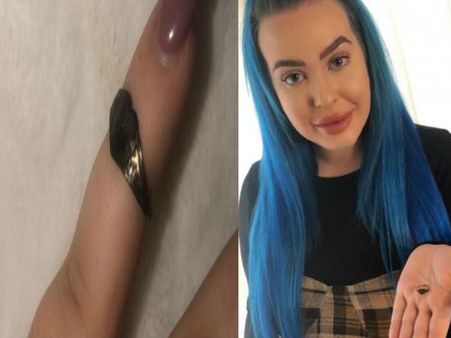 महिला ने मारी छींक तो नाक से निकली 12 साल पुरानी अंगूठी, हर कोई देखकर रह गया हैरान