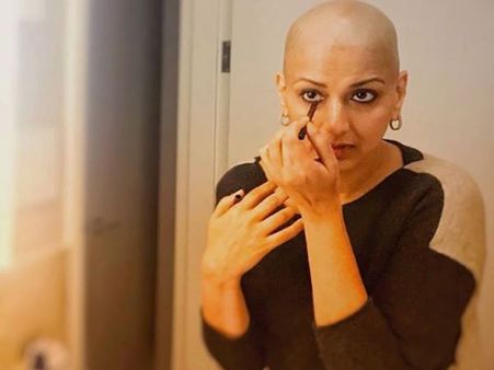 'घने बालों की वजह से मिली थी पहली फिल्म, कैंसर के चलते गंजा होना पीड़ादायक'