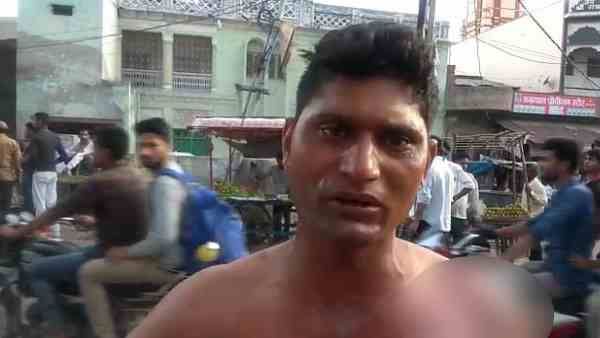 समोसा का 1 रुपए नहीं दिया तो दुकानदार ने युवक के ऊपर डाल दिया खौलता तेल, Video