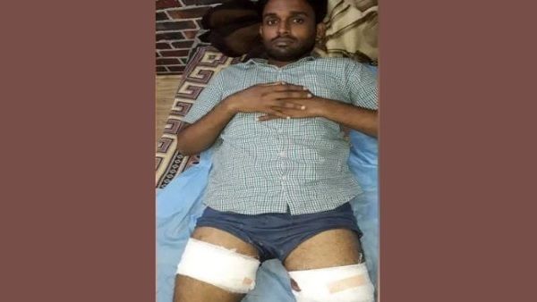 अक्षरधाम के पास पुलिस और बदमाशों के बीच मुठभेड़, स्पेशल सेल के हत्थे चढ़ा कुख्यात बदमाश