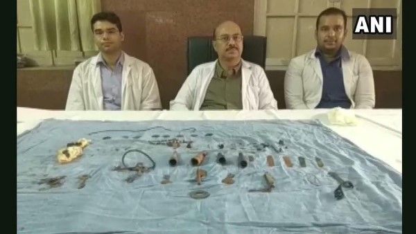 युवक के पेट से निकलीं अंगूठी, चिलम, नेलकटर, चाकू समेत 80 चीजें, डॉक्टर रह गए हैरान