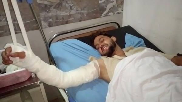 पहली बीवी के घरवालों ने रोका दामाद का रास्ता, दूसरी बीवी के साथ ही उसे तेजाब से जला दिया