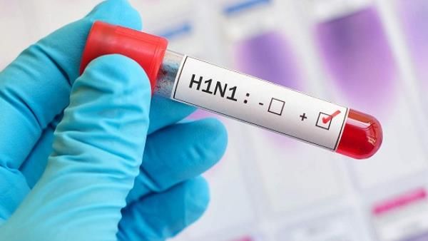 अलर्ट! MP का ये शहर बना स्वाइन फ्लू का हॉट स्पॉट, अब तक मिल चुके हैं इतने मरीज