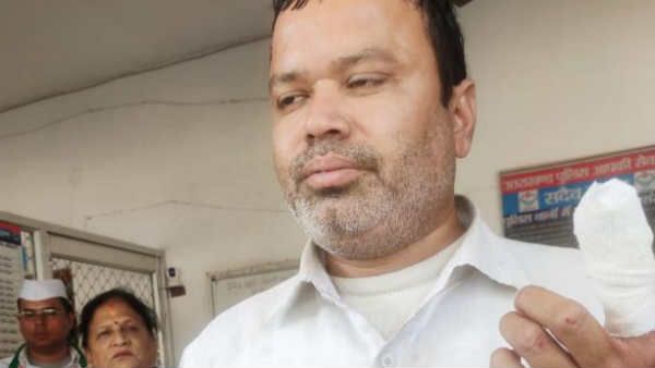 प्‍याज की कीमतों को लेकर हो रहा था प्रदर्शन, कथित BJP समर्थक ने दांत से काटकर अलग कर दी कांग्रेस नेता की अंगुली