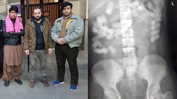 डॉक्टरों ने अफगानी नागरिकों के पेट से निकाला 1 किलो से भी ज्यादा हेरोइन, दिल्ली में करने आए थे सप्लाई