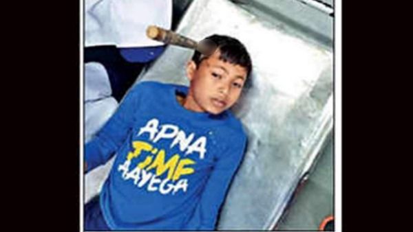 स्पोर्ट्स इवेंट के दौरान छात्र के सिर में घुसा भाला, जान तो बच गई लेकिन...