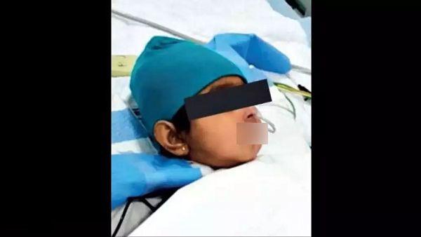 गुजरात में पहली बार सबसे कम उम्र की बच्ची का लिवर ट्रांसप्लांट, मां ने ही डॉनेट किया एक हिस्सा