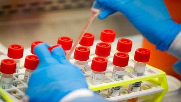 IIT दिल्ली ने लॉन्च की दुनिया की सबसे सस्‍ती कोविड -19 टेस्टिंग किट, जानें कितनी होगी कीमत