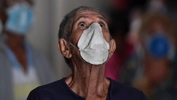 देशभर के कोरोना मरीजों के लिए खतरे की घंटी, मुंह के लकवे का कारण बन रहा COVID-19