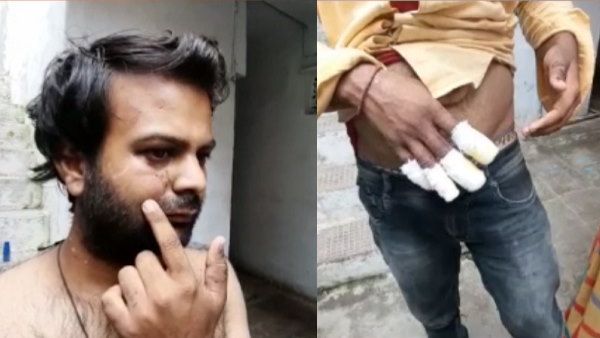 उज्जैन: पंडिताई करने वाले ने युवक को घर ले जाकर उसके हाथ के नाखून उखाड़े