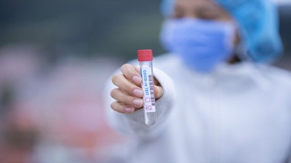  छत्तीसगढ़: 11 वायरोलाजी लैब में 350 लोगों की टीम ने जांचे 20 लाख से अधिक सैंपल