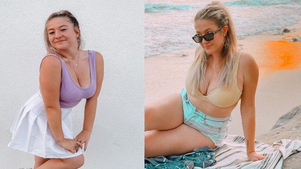 'उसी शेप में आ गए...' ब्रेस्ट रिडक्शन सर्जरी करवाने वाली डांसर का दर्द, सुनाई आपबीती