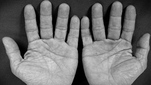 Palmistry: हस्तरेखा के कुछ दुर्लभ योग जो मनुष्य को बनाते हैं भाग्यशाली