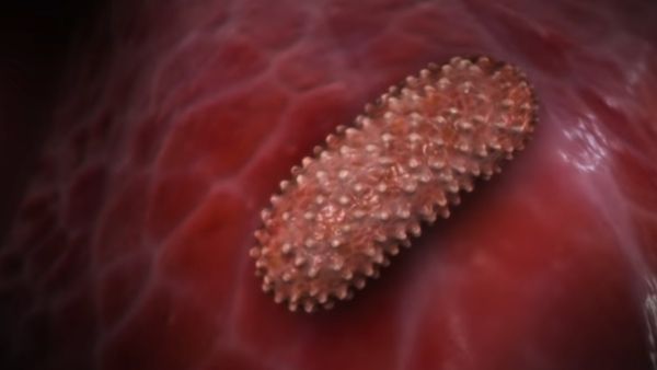 काली मौत: दुनिया में फिर ब्यूबोनिक प्लेग महामारी फैलने का गंभीर खतरा, शीर्ष रूसी डॉक्टर की चेतावनी