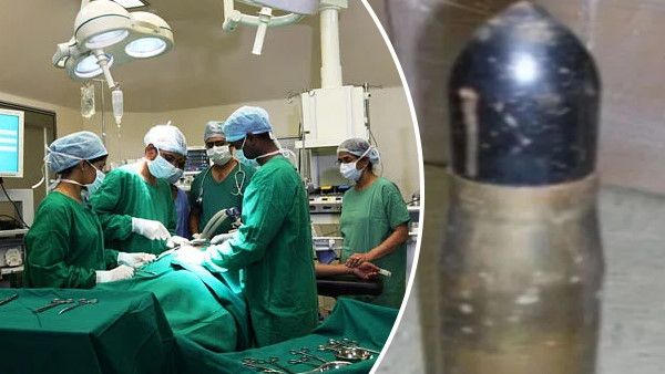 प्राइवेट पार्ट में फंस गया विश्व युद्ध-II का गोला, ऑपरेशन थिएटर में बुलाना पड़ा बम स्क्वाड