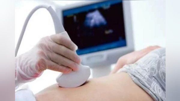 OMG! महिला के लिवर में विकसित हो रहा था भ्रूण, डॉक्टर बोले- पहले कभी नहीं देखा ऐसा केस