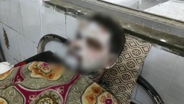 ट्रेन में एसिड अटैक : युवती ने युवक के चेहरे पर फेंका तेजाब, यात्रियों में मची अफरा-तफरी, देखें VIDEO