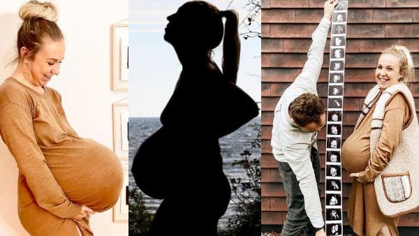 OMG! एक-दो नहीं, महिला के पेट में पल रहे थे इतने बच्चे, 35 हफ्ते में बेबी बंप का हुआ ये हाल