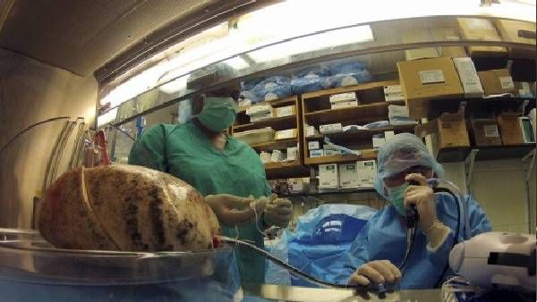 अब सांस लेना भी घातक! जिंदा इंसान के लंग्स में मिले माइक्रोप्लास्टिक, टेंशन में वैज्ञानिक