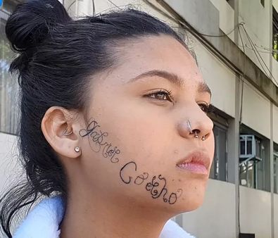 बॉयफ्रेंड का बदला! गर्लफ्रेंड ने की बेवफाई, तो चेहरे पर बनवा दिया अपने नाम का परमानेंट टैटू