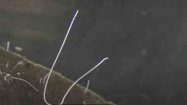 दुनिया का सबसे विशाल बैक्टीरिया मिला, नंगी आंखों से दिखता है थियोमार्गरीटा मैग्निफा, जानिए कितनी है लंबाई