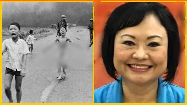 वियतनाम जंग की बेरहम तस्वीर, बिना कपड़ों के भागी थी लड़की,50 साल बाद हुआ अंतिम ऑपरेशन