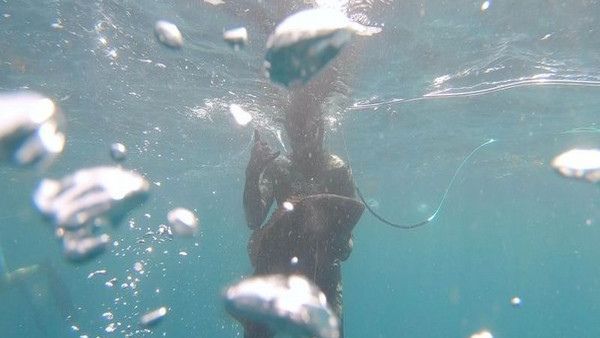 पानी से कूदकर मछली गले में फंसी, मछुआरे की सांस की नली गिर गई नीचे... और फिर जानिए क्या हुआ