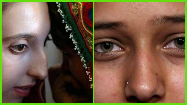 तालिबान राज में अफगान महिलाएं कर रही हैं 'आत्महत्या', बेची जा रही हैं लड़कियां