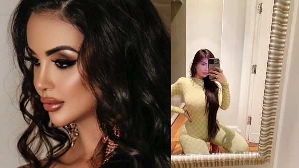 किम कार्दशियन जैसी दिखने के लिए मॉडल ने 12 साल में कराई 40 सर्जरी, लाखों खर्च के बाद अब हुआ बुरा हाल