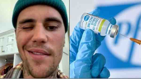 Fact Check: कोविड वैक्सीन की वजह से पैरालिसिस का शिकार हुए जस्टिन बीबर का चेहरा? जानें सच
