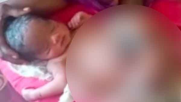 मिर्जापुर: महिला ने अजीबो गरीब बच्चे को दिया जन्म, देखने जुटी भारी भीड़