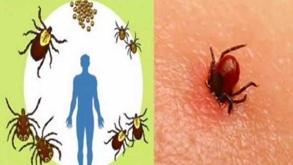 Scrub Typhus Alert Mp: नए खतरे की आहट? जानें क्या है स्क्रब टाइफस, सतना में मिले इसके 4 मरीज
