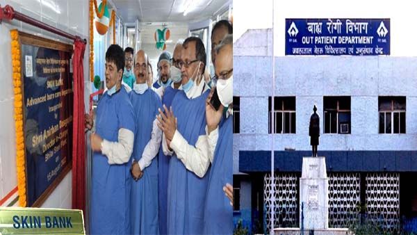 Chhattisgarh का पहला SKIN BANK, BSP ने की शुरुआत, 80 प्रतिशत बर्न मरीजों को मिलेगा जीवनदान