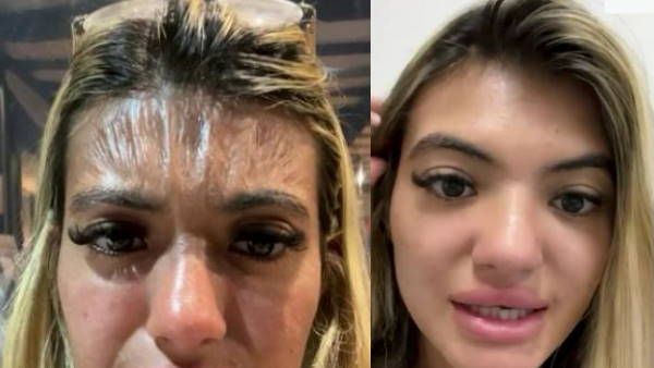 खूबसूरती प्लास्टिक में बदली! समंदर में नहाकर बाहर निकली लड़की को लगा अजीब रोग