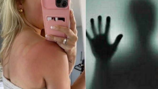 'क्या यह पिशाच का हाथ है?' बाथरूम से निकली महिला तो पीठ पर दिखा रहस्यमयी निशान