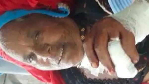 लुटेरे से अकेले ही भिड़ गई 70 साल की भंवरीदेवी, अंगुलियां कटने पर भी नहीं हारी हिम्‍मत