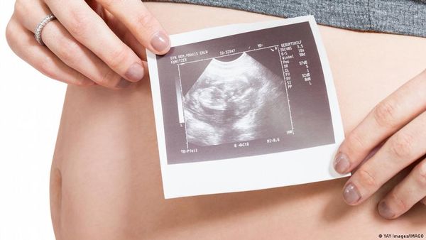 गर्भ में भी बच्चों के चेहरे गाजर के स्वाद से खिल उठते हैं