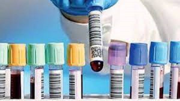 गोरखपुर: स्वास्थ्य विभाग ने मरीजों के लिए शुरु की यह विशेष सुविधा,आप भी उठाएं लाभ