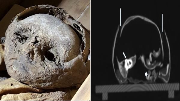 Mummified Baby: तहखाने में रखी 400 साल पुरानी बच्चे की 'ममी का राज'! साइंटिस्ट्स ने खोज निकाली मौत की वजह