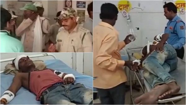 Panna Tiger Reserve: झाड़ियों में छिपे भालुओं का इंसानों पर हमला, चेहरे और हाथों का मांस नोच ले गए