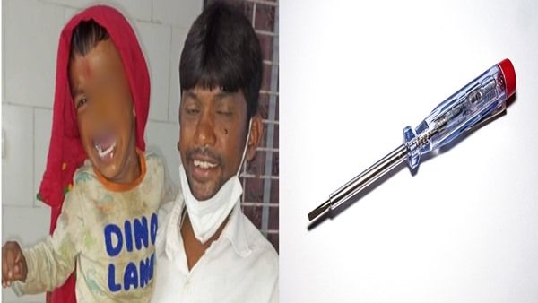 Miracle: बच्चे की आंख में घुसा नुकीला पेंचकस, फिर हुआ अचानक करिश्मा, क्योंकि डॉक्टर खड़े कर चुके थे हाथ