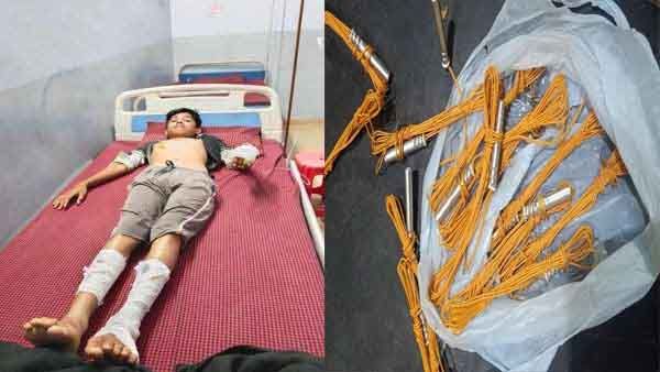 Durg News: मंदिर में रखा डेटोनेटर ब्लास्ट, पूजा करने पहुंचा बच्चा बुरी तरह घायल, माइंस से हुई डेटोनेटर की चोरी