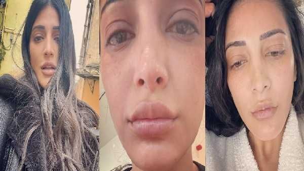 श्रुति हासन की फोटोज में दिखीं सूजी आंखें और बिखरे बाल, आखिर कैसे हुआ उनका ये हाल