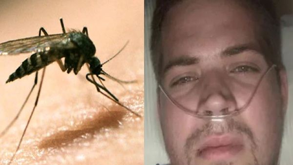 'एक मच्छर इंसान को.....', कोमा में शख्स, 2 अंगुलियां कटाने के बाद हुए 30 से ज्यादा ऑपरेशन