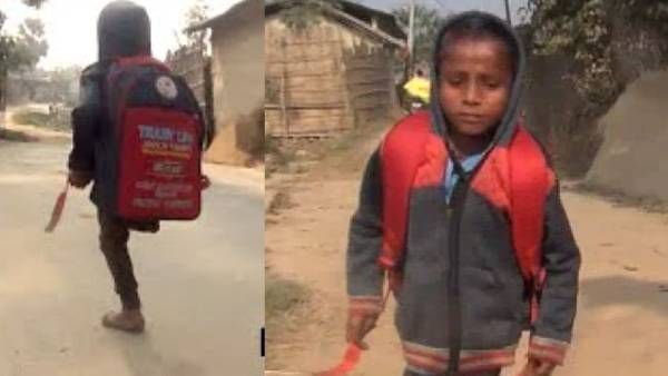 एक पैर से 1 KM कूद कर स्कूल जाता है प्रशांत, लगवाए गए कृत्रिम पैर, इस वजह से नहीं हो पाया था इलाज