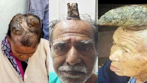 अजब-गजब: पहले श्यामलाल और अब मिमियाबाई के सिर पर उग रहे सींग