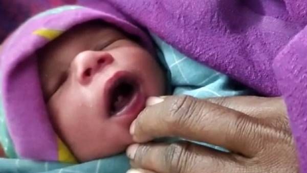 Jamui News: मुंह में दांत के साथ नवजात ने लिया जन्म, हैरत में लोग, डॉक्टर ने बताई ये वजह