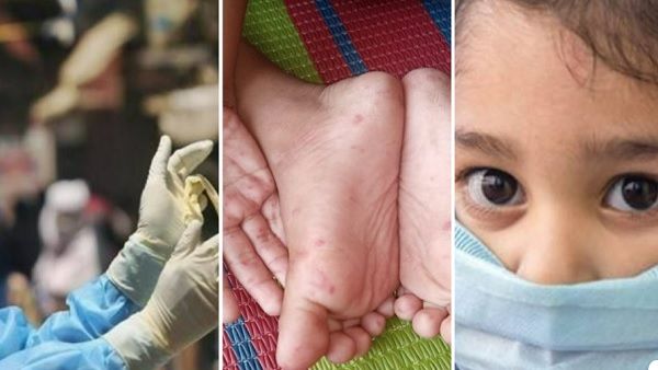 Year Ender 2022: साल की 5 सबसे बड़ी बीमारी जिसने तबाह कर दी लोगों की जिंदगी, इसके कहर से हुई सबसे अधिक मौत